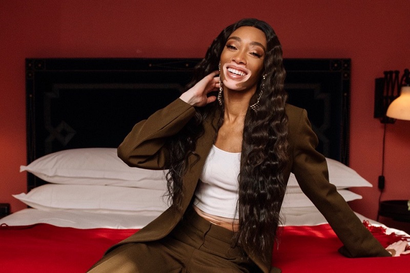 Winnie Harlow Says Makeup Artists and Hairstylists Are Still Failing Black Models